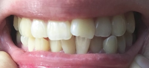 a18fd5d2d513541c9873eeeb2a4cc8cb_1516206375_8412.jpg a18fd5d2d513541c9873eeeb2a4cc8cb_1516206