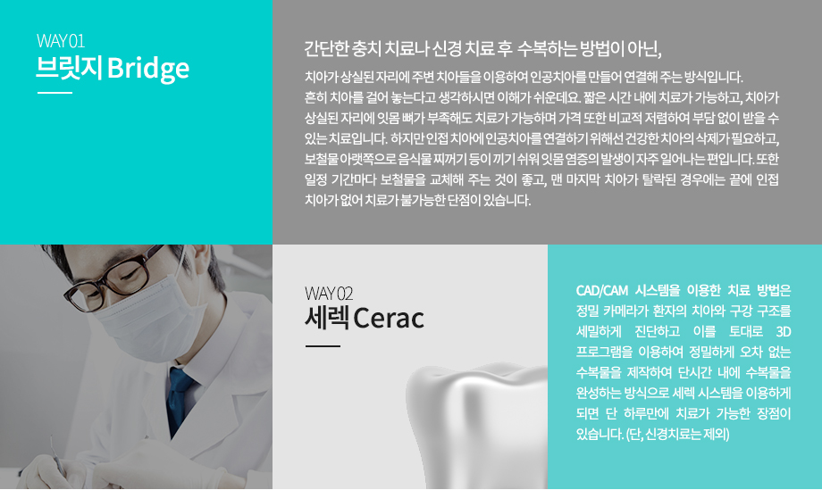 -브릿지
간단한 충치 치료나 신경 치료 후 수복하는 방법이 아닌 치아가 상실된 자리에 주변 치아들을 이용하여 인공치아를 만들어 연결해 주는 방식입니다. 흔히 치아를 걸어 놓는다고 생각하시면 이해가 쉬운데요. 짧은 시간 내에 치료가 가능하고, 치아가 상실된 자리에 잇몸 뼈가 부족해도 치료가 가능하며 가격 또한 비교적 저렴하여 부담 없이 받을 수 있는 치료입니다.  하지만 인접 치아에 인공치아를 연결하기 위해선 건강한 치아의 삭제가 필요하고, 보철물 아랫쪽으로 음식물 찌꺼기 등이 끼기 쉬워 잇몸 염증의 발생이 자주 일어나는 편입니다. 또한 일정 기간마다 보철물을 교체해 주는 것이 좋고, 맨 마지막 치아가 탈락된 경우에는 끝에 인접 치아가 없어 치료가 불가능한 단점이 있습니다.
-세렉
CAD/CAM 시스템을 이용한 치료 방법은 정밀 카메라가 환자의 치아와 구강 구조를 세밀하게 진단하고 이를 토대로 3D 프로그램을 이용하여 정밀하게 오차 없는 수복물을 제작하여 단시간 내에 수복물을 완성하는 방식으로 세렉 시스템을 이용하게 되면 단 하루만에 치료가 가능한 장점이 있습니다. (단, 신경치료는 제외)

